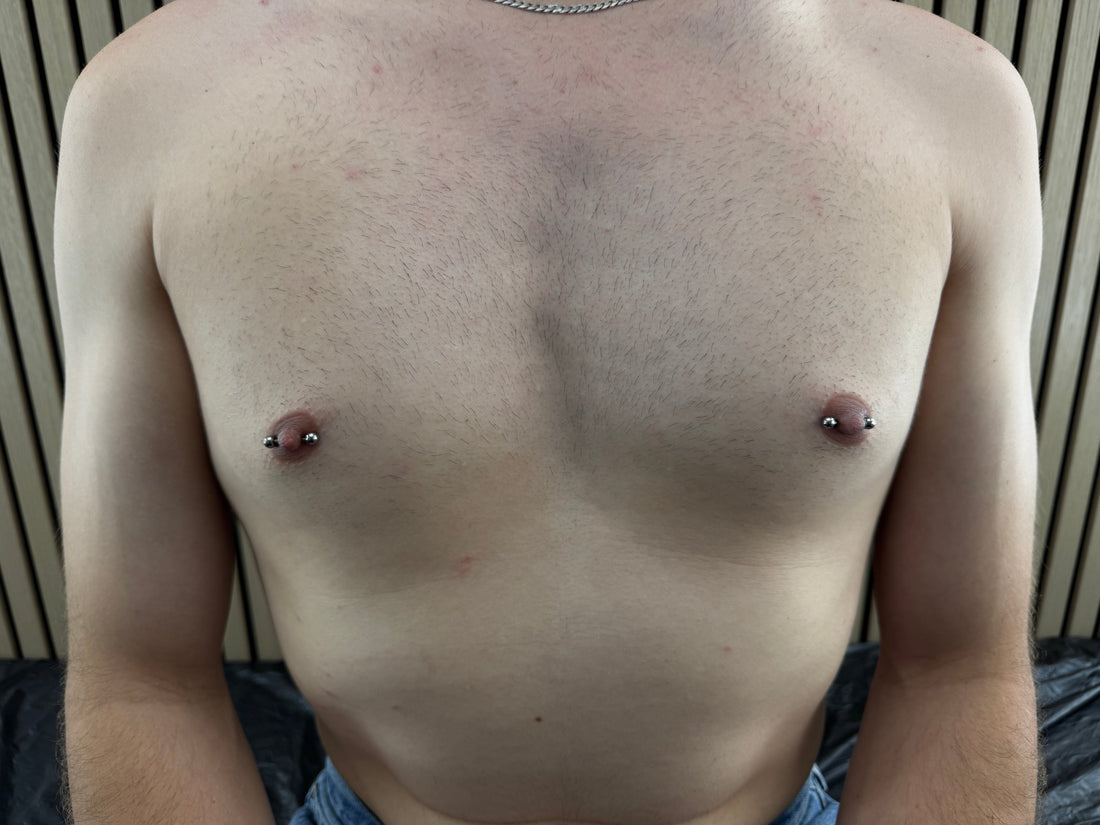 Schlupfwarzenkorrektur: Alles, was du vor dem Piercing wissen musst